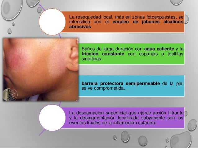 discromias cutaneas